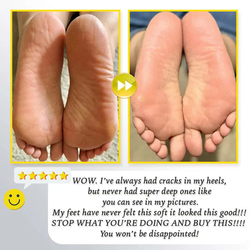 🔥HOT SALE 57% UIT🔥Oplaadbare elektrische scrub voor voeten