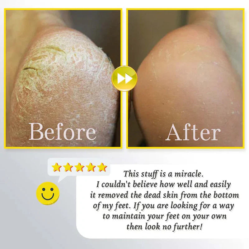 🔥HOT SALE 57% UIT🔥Oplaadbare elektrische scrub voor voeten