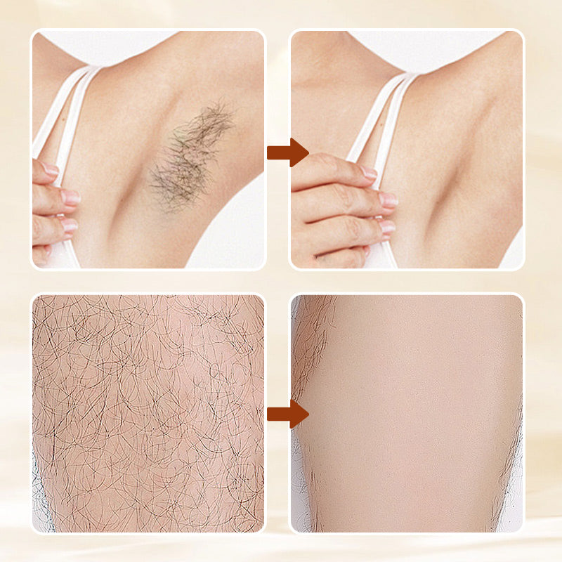 🧴【Geurige ontharingscrème】— Lost haar in slechts 3 minuten op en zorgt voor een gladheid zoals in een spa! 🌸✨
