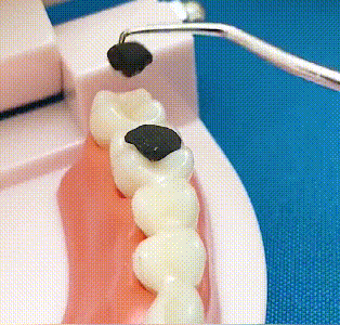 🏆Duitse precisietechniek! 0,1 mm ultrafijne punt voor nauwkeurig flossen✨